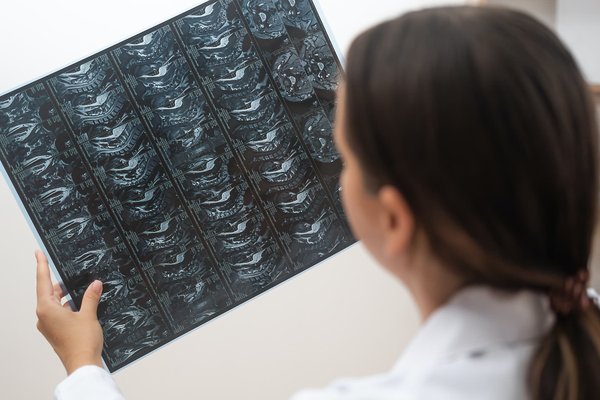 Le magnétisme à distance: une solution efficace